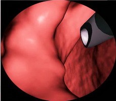 點擊瀏覽下一頁