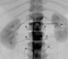 點擊瀏覽下一頁