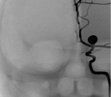 點擊瀏覽下一頁