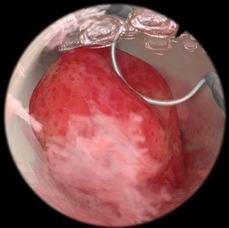 醫(yī)學(xué)教學(xué)模型 點(diǎn)擊瀏覽下一頁(yè)