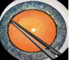 醫(yī)學(xué)教學(xué)模型 點(diǎn)擊瀏覽下一頁