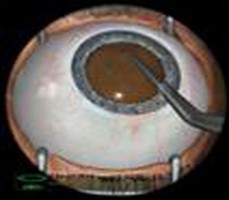 醫(yī)學(xué)教學(xué)模型 點(diǎn)擊瀏覽下一頁