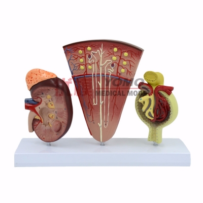 人體腎模型