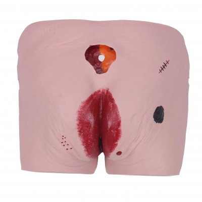 高級壓瘡(褥瘡)護理模型