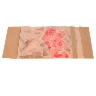 肢體燒傷訓練模塊